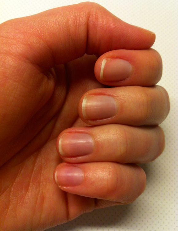 Après le retrait du vernis semi-permanent