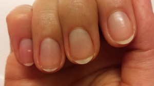 Après le retrait de Vinylux